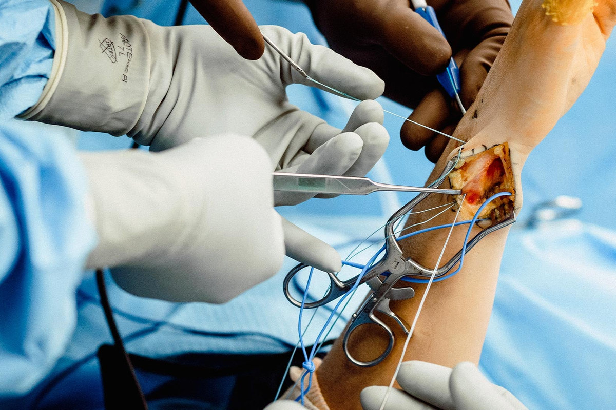 Wrist Arthroscopy: Minimally Invasive Diagnosis and Treatment for Wrist Pain